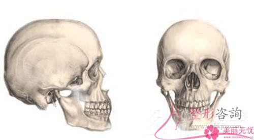 做下颌骨磨骨有什么副作用