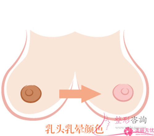 进行<a href=http://www.washiqing.com/listinfo-625-0.html target=_blank class=infotextkey>乳晕缩小</a>术之前需要避免服用什么药物