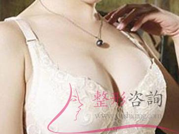 哺乳期可以做水光美容吗