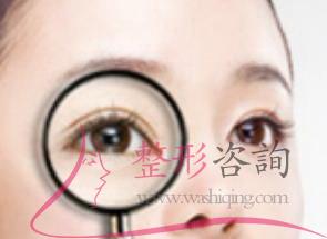 保定哪家医院做<a href=http://www.washiqing.com/listinfo-724-0.html target=_blank class=infotextkey>双眼皮</a>