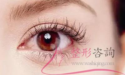 什么眼型适合<a href=http://www.washiqing.com/listinfo-711-0.html target=_blank class=infotextkey>开眼角</a>