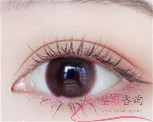 营口市站前区<a href=http://www.washiqing.com/listinfo-711-0.html target=_blank class=infotextkey>开眼角</a>手术排名前十位综合实力医生口碑介绍